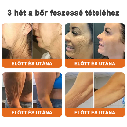 💝Készült és szállított az Egyesült Királyságból✨EdiJonah™ Botox Bee Venom Firming Serum Stick🔥LAST DAY 70% OFF✨✨✨