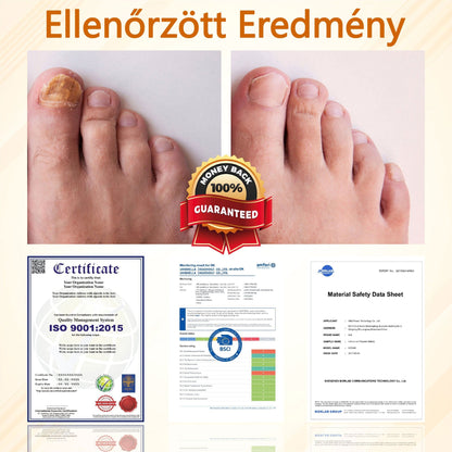 Croaie® Fungiclear Bee Therapy Nail Spray🎁