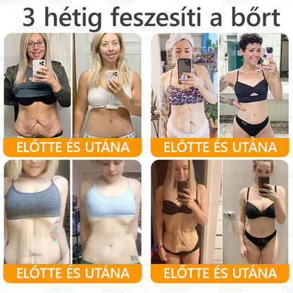 Daasry® Méhméreg Krém – Természetes bőrfeszesítés és ránctalanítás klinikai hatékonysággal! ✨✨✨