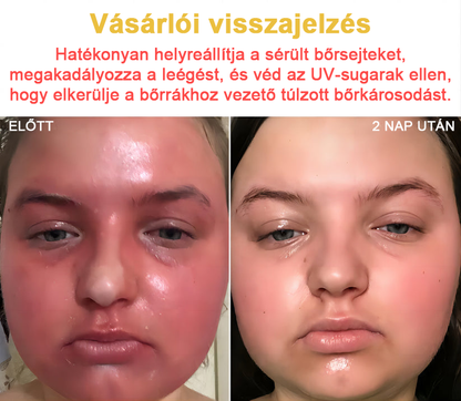 2024 ÚJ Velisse™ méhméreg bőrkrém（🧑‍⚕️AAD ajánlott), a szemölcsök, akné és hegek eltávolítására – többféle bőrbetegség kezelésére