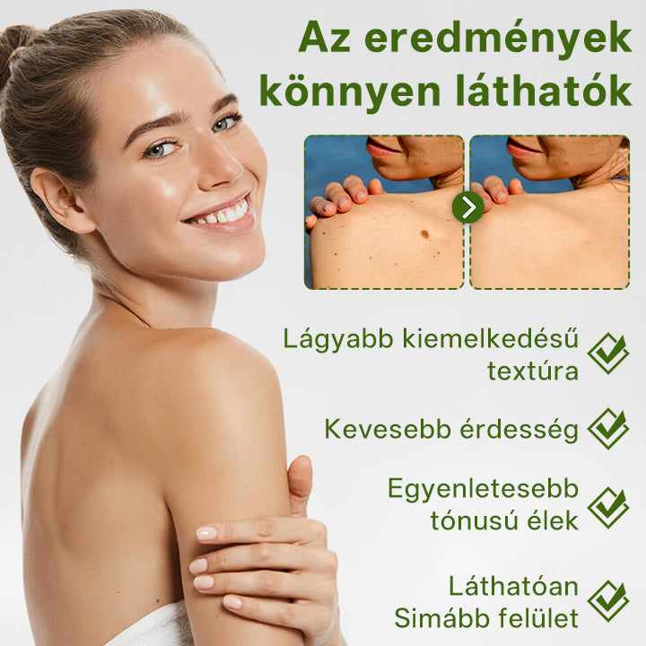 🔥🔥Timilk® ThujaClear növényi szemölcs krém