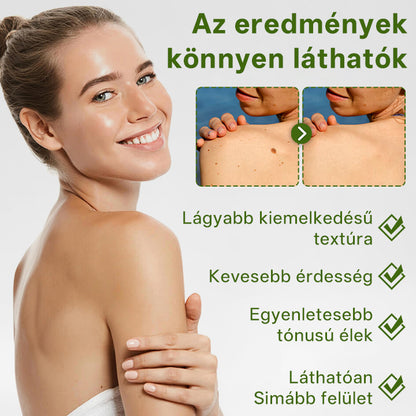 🔥🔥Timilk® ThujaClear növényi szemölcs krém