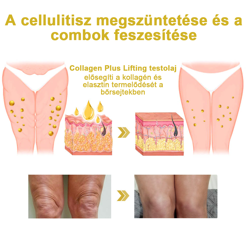 2025. évi Readers' Choice-díjasok🏆 𝐌𝐨𝐨𝐧𝐝𝐚𝐫™ 𝐟𝐞𝐬𝐳𝐞𝐬í𝐭ő 𝐟𝐢𝐚𝐭𝐚𝐥í𝐭ó 𝐤𝐫é𝐦: 𝐕𝐢𝐬𝐬𝐳𝐚á𝐥𝐥í𝐭𝐣𝐚 𝐚 𝐛ő𝐫 𝐫𝐮𝐠𝐚𝐥𝐦𝐚𝐬𝐬á𝐠á𝐭