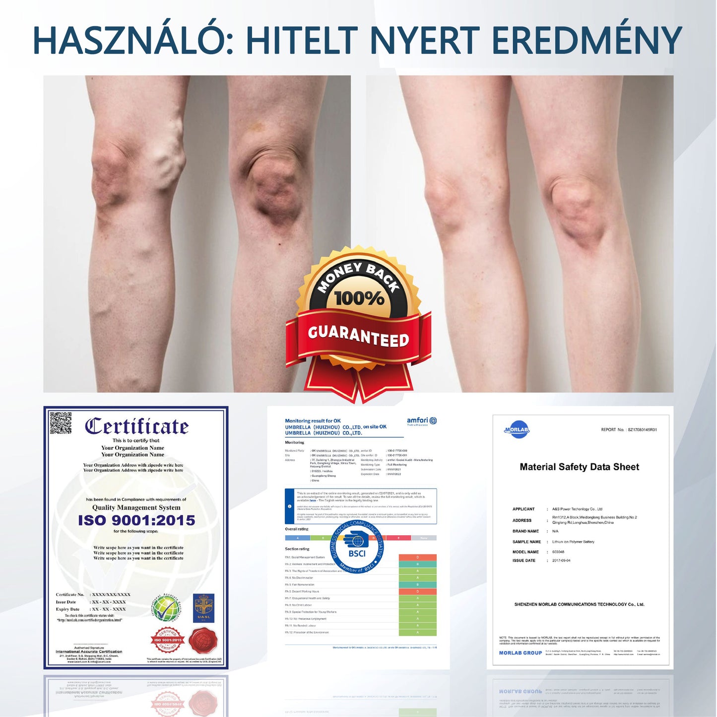 ✅✅ODEIUN® Fekete kömény Ödéma méregtelenítő gyógynövénykrém