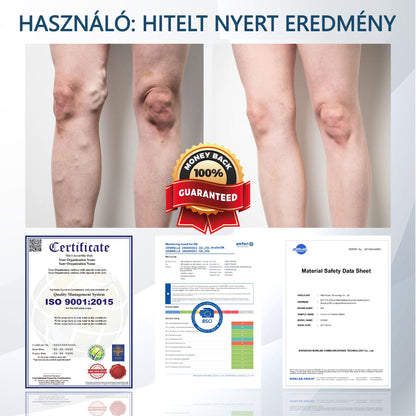 ✅✅ODEIUN® Fekete kömény Ödéma méregtelenítő gyógynövénykrém