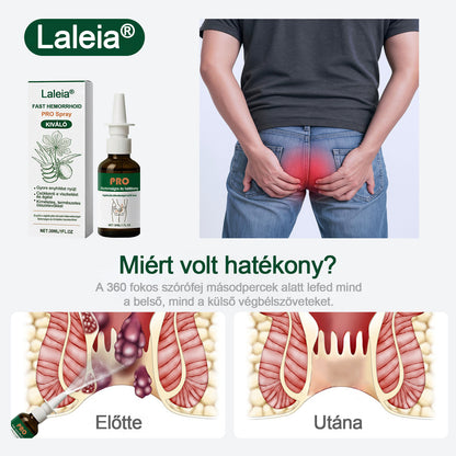 🎁Újévi különleges ajánlat | Laleia® Gyors Aranyér PRO Spray