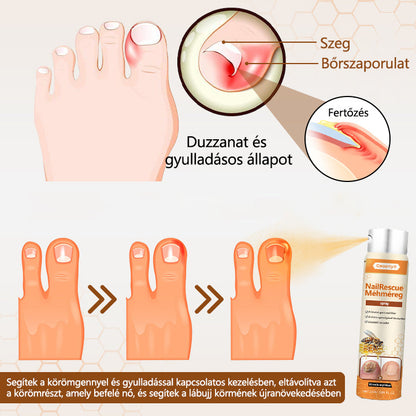 ✅[Korlátozott idejű ajánlat, érkezési sorrendben]✅Ceoerty® NailRescue méhméreg spray