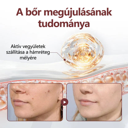 🔥🔥🔥🔥Croaie® fekete rizs kettős hatású megújító krém