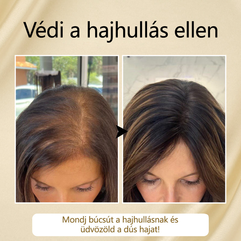 Timilk® VitaStrand Biotin hajnövekedést elősegítő spray✅ Sűrű, fényes haj néhány hét alatt