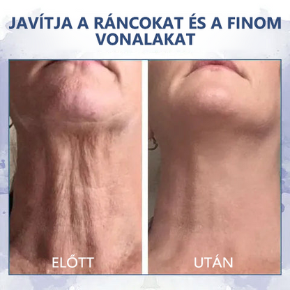 🫧Utolsó napi kedvezmény: 80% kedvezmény🫧Fubsta® Advanced Firming & Anti-Wrinkle Cream: helyreállítja a bőr rugalmasságát🫧