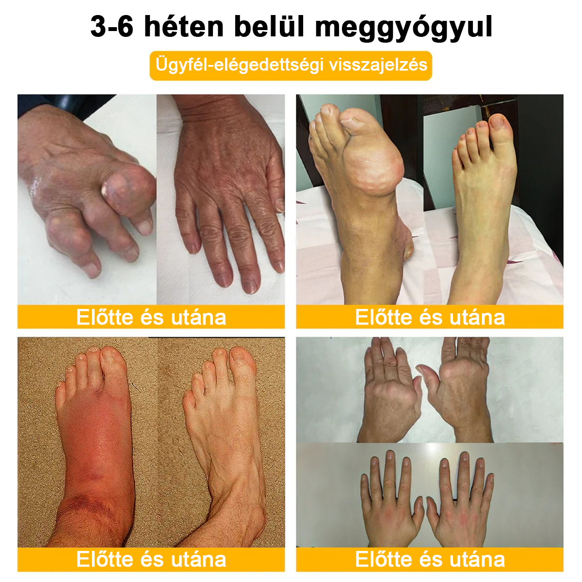 𝐀𝐫𝐭𝐡𝐫𝐨𝐅𝐫𝐞𝐞™Méhméreg fájdalomcsillapító csontgyógyító krém(Különösen az idősebb felnőtteknek és a DGOU által ajánlott) ✨Különleges ajánlat korlátozott ideig✨