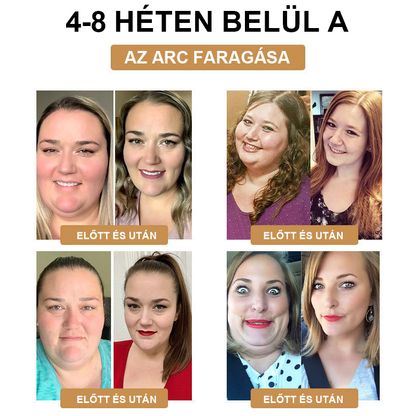 👑ZVLZVL™ Méhméreg Lymphatic DetoxFogyasztó Tapasz 🔥𝐊𝐨𝐫𝐥á𝐭𝐨𝐳𝐨𝐭𝐭 𝐢𝐝𝐞𝐢𝐠 𝟕𝟎% 𝐊𝐄𝐃𝐕𝐄𝐙𝐌É𝐍𝐘🔥 (Szabadalmazott módszerrel az összes korosztály számára)