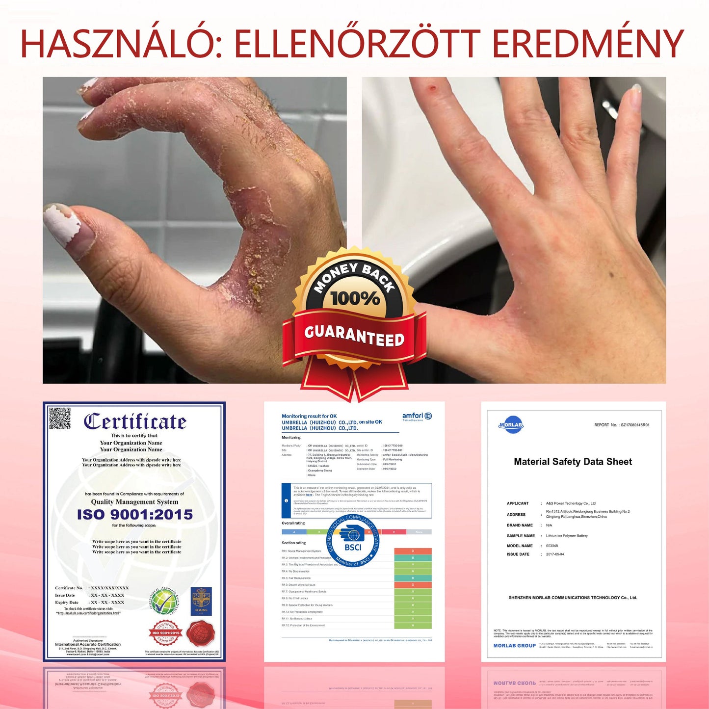 ⭐⭐⭐ATTDX® GlucoseGuard bőrmentő krém
