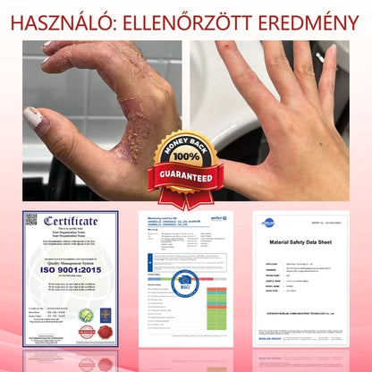 ⭐⭐⭐ATTDX® GlucoseGuard bőrmentő krém