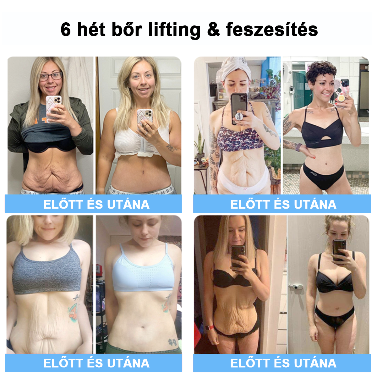 75% kedvezmény 🎉 Fubsta® Fejlett feszesítő és ránctalanító krém: Visszaállítja a bőr rugalmasságát 💧 Élénkítse fel bőrét, és ragyogjon 2025-ben! 🌟✨