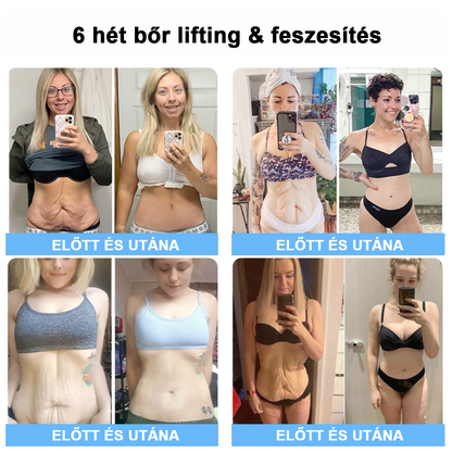 75% kedvezmény 🎉 Fubsta® Fejlett feszesítő és ránctalanító krém: Visszaállítja a bőr rugalmasságát 💧 Élénkítse fel bőrét, és ragyogjon 2025-ben! 🌟✨