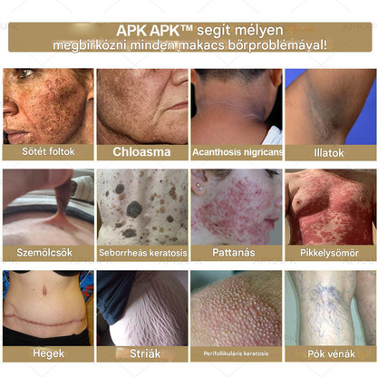 𝑨𝑷𝑲𝑨𝑷𝑲™ Hatékony krém a teljes bőrápoláshoz🔥