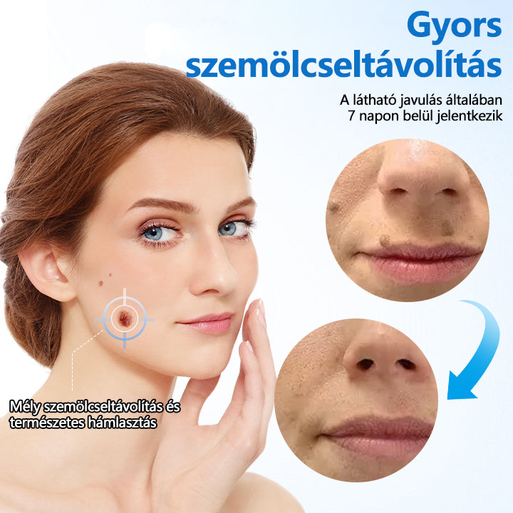 👨‍⚕️Timilk® TagGone szemölcs eltávolító krém