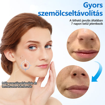 👨‍⚕️Timilk® TagGone szemölcs eltávolító krém