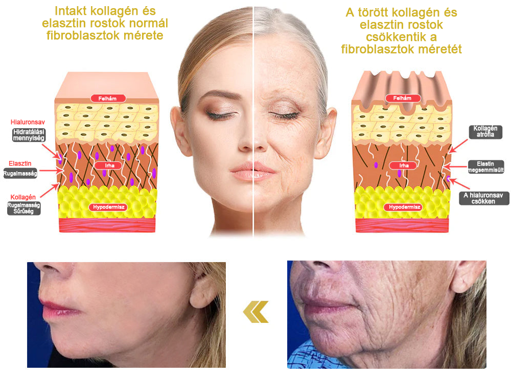 2025. évi Readers' Choice-díjasok🏆 𝐌𝐨𝐨𝐧𝐝𝐚𝐫™ 𝐟𝐞𝐬𝐳𝐞𝐬í𝐭ő 𝐟𝐢𝐚𝐭𝐚𝐥í𝐭ó 𝐤𝐫é𝐦: 𝐕𝐢𝐬𝐬𝐳𝐚á𝐥𝐥í𝐭𝐣𝐚 𝐚 𝐛ő𝐫 𝐫𝐮𝐠𝐚𝐥𝐦𝐚𝐬𝐬á𝐠á𝐭