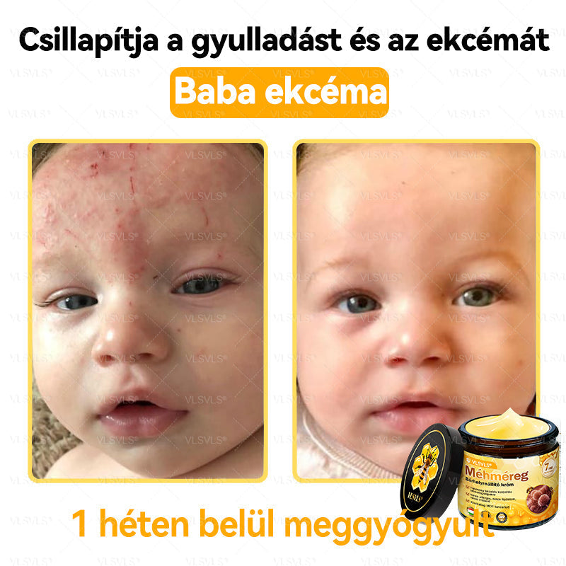 💪VLSVLS® Méhméreg Bőrhelyreállító Krém (👨‍⚕‍CE jóváhagyott)👍✅✅