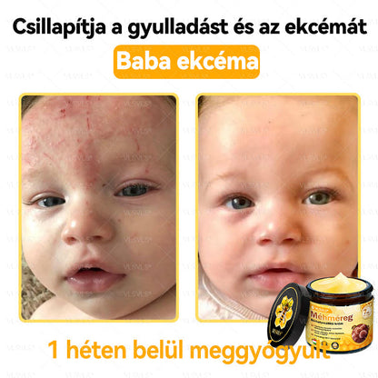 💪VLSVLS® Méhméreg Bőrhelyreállító Krém (👨‍⚕‍CE jóváhagyott)👍✅✅