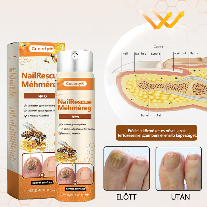 ✅[Korlátozott idejű ajánlat, érkezési sorrendben]✅Ceoerty® NailRescue méhméreg spray