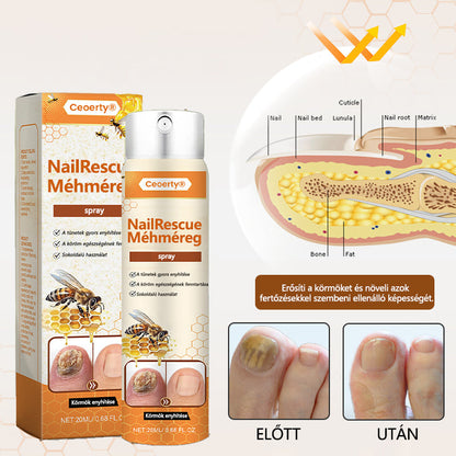 ✅[Korlátozott idejű ajánlat, érkezési sorrendben]✅Ceoerty® NailRescue méhméreg spray