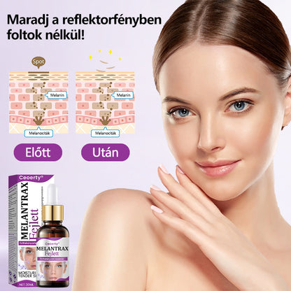 ✨✨✨Ceoerty® MelantraX Advanced Anti-Hyperpigmentáció elleni esszencia