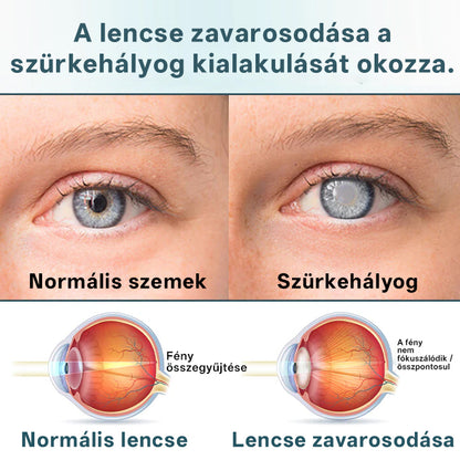 🔥Laleia® OptiFusion Nano szemcsepp szérum🎉