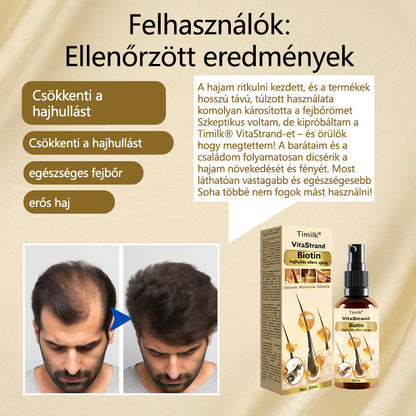 Timilk® VitaStrand Biotin hajnövekedést elősegítő spray✅ Sűrű, fényes haj néhány hét alatt