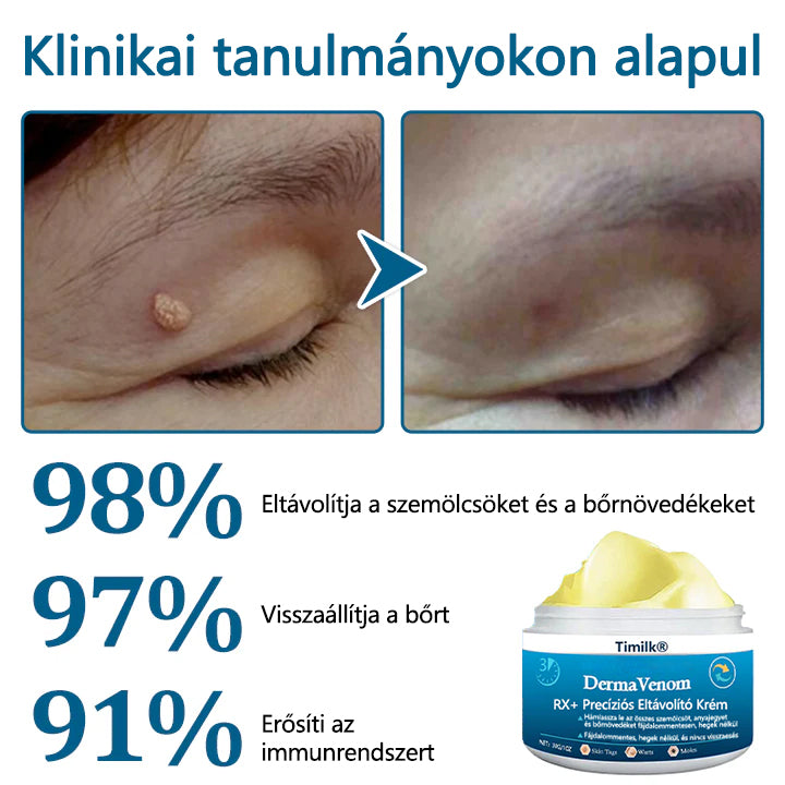 🔥🔥Timilk® DermaVenom RX+ precíziós eltávolító krém