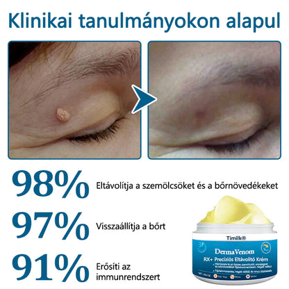 🔥🔥Timilk® DermaVenom RX+ precíziós eltávolító krém