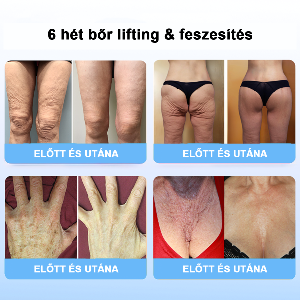 75% kedvezmény 🎉 Fubsta® Fejlett feszesítő és ránctalanító krém: Visszaállítja a bőr rugalmasságát 💧 Élénkítse fel bőrét, és ragyogjon 2025-ben! 🌟✨