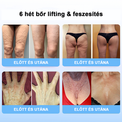 75% kedvezmény 🎉 Fubsta® Fejlett feszesítő és ránctalanító krém: Visszaállítja a bőr rugalmasságát 💧 Élénkítse fel bőrét, és ragyogjon 2025-ben! 🌟✨