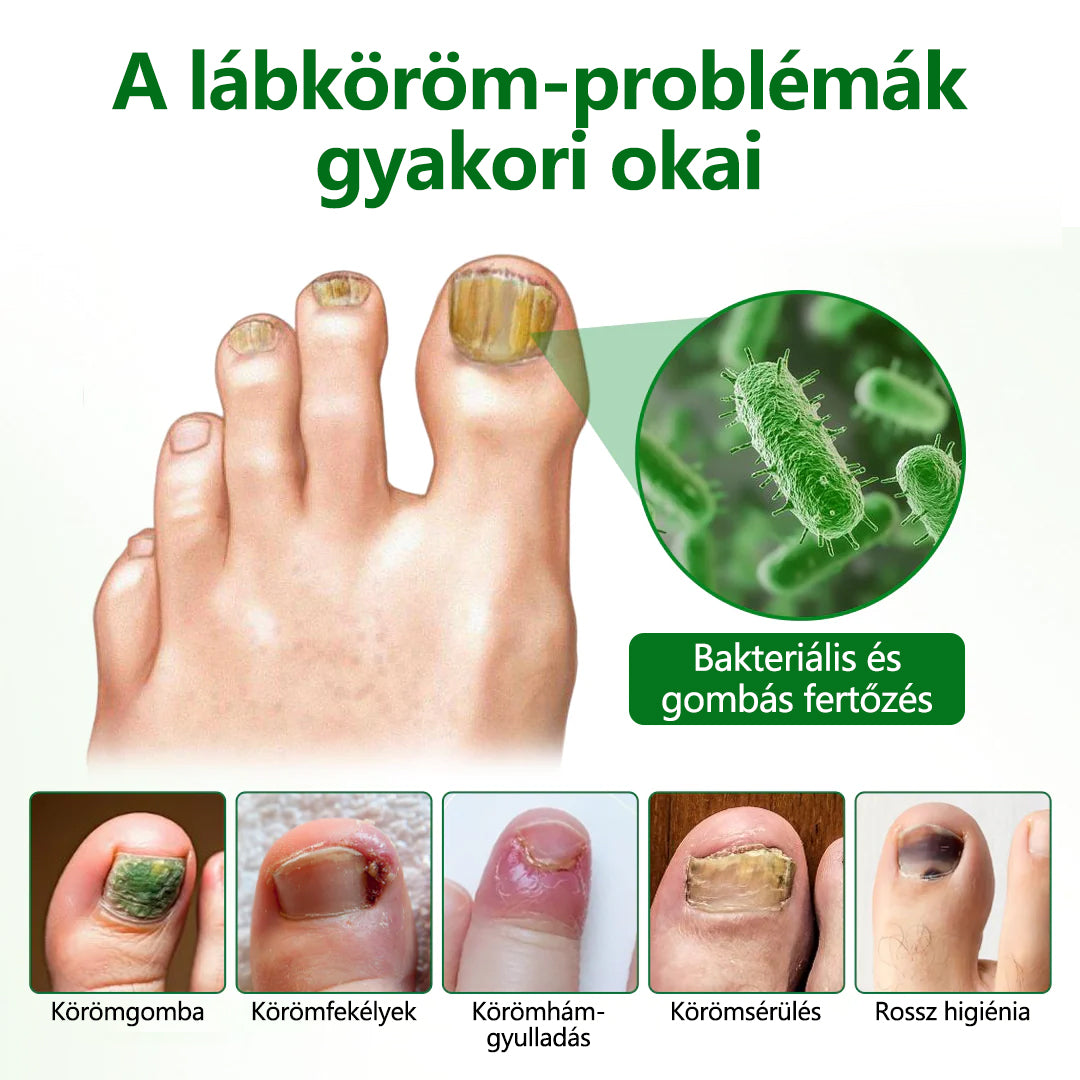 Timilk® HerbaNail 7 napos regeneráló szérum 🔥🔥 FDA tanúsítvánnyal rendelkezik