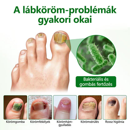 Timilk® HerbaNail 7 napos regeneráló szérum 🔥🔥 FDA tanúsítvánnyal rendelkezik