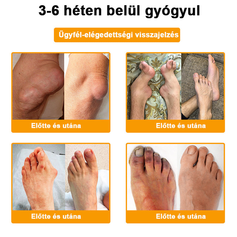 💧🐝TLOPA® Botulinum Toxin & Méhméreg Fájdalomcsillapító Csontgyógyító Krém👨‍⚕️A Magyar Ortopéd Társaság (MOT) Által Jóváhagyva