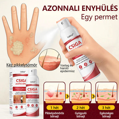 🔥Laleia® csigahéjas spray viszkető, hámló pikkelysömörös bőrre