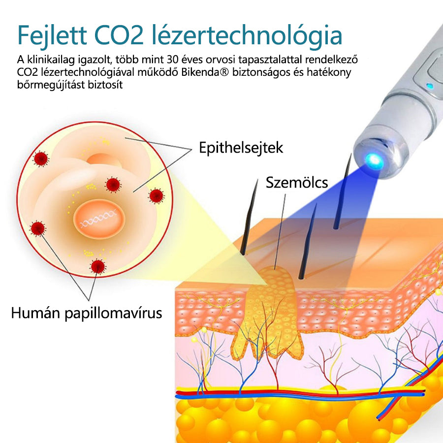 ✅Bikenda® LumeSkin anyajegy és szemölcs eltávolító lézeres toll
