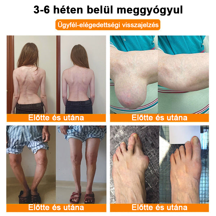 ✅Hivatalos Áruház: Ourlyard™ Magnézium Olaj és Méhméreg ízületjavító spray 👨‍⚕️ A Gyógyszerügyi Hivatal (OGYEI) jóváhagyásával.