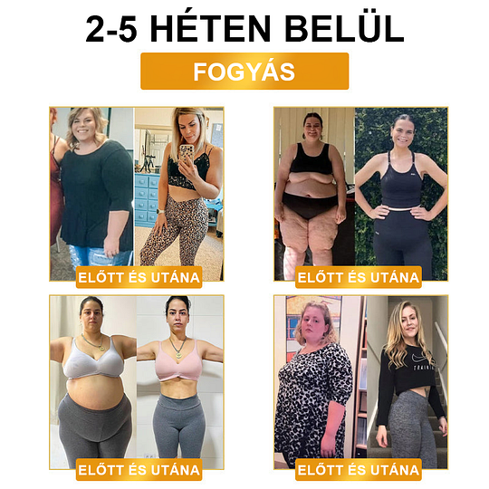 【 ⭐ utánvétel (COD) ⭐ 】𝐉𝐎𝐒𝐅𝑰𝐓™ ultrahangos zsírfúvás és távoli infravörös vércukorszint-kiegyenlítő méregtelenítő csuklópánt - Energy Balance 🔥 Korlátozott idejű akció 🔥