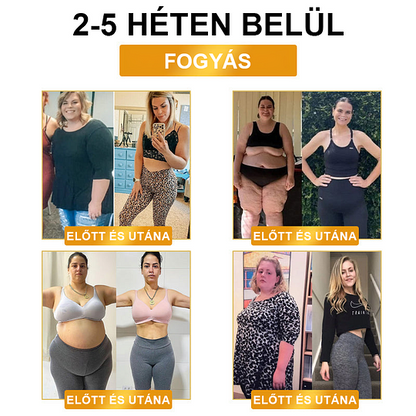 【 ⭐ utánvétel (COD) ⭐ 】𝐉𝐎𝐒𝐅𝑰𝐓™ ultrahangos zsírfúvás és távoli infravörös vércukorszint-kiegyenlítő méregtelenítő csuklópánt - Energy Balance 🔥 Korlátozott idejű akció 🔥