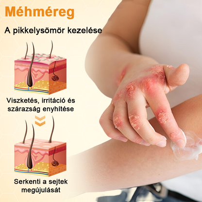 Timilk® BeeLieve Psoriasis bőrápolás🌿🌿