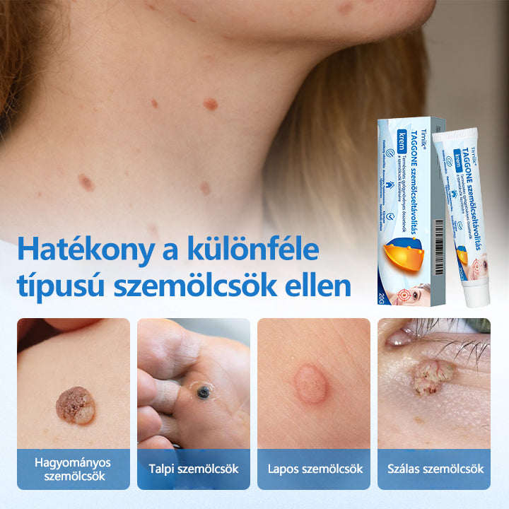 👨‍⚕️Timilk® TagGone szemölcs eltávolító krém
