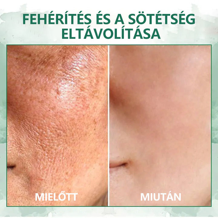 🌿💝A 60%-os akció utolsó napja - Fubsta™ öregedésgátló bőrfeszesítő szérum🔥🔥