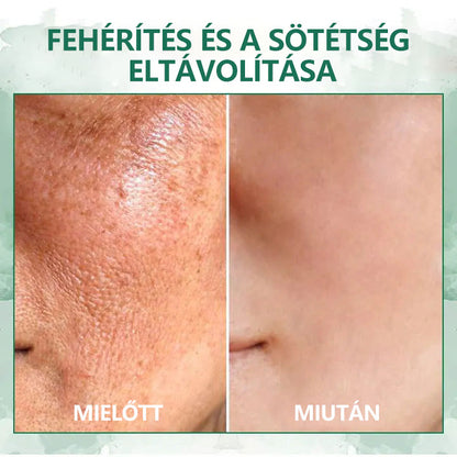 🌿💝A 60%-os akció utolsó napja - Fubsta™ öregedésgátló bőrfeszesítő szérum🔥🔥