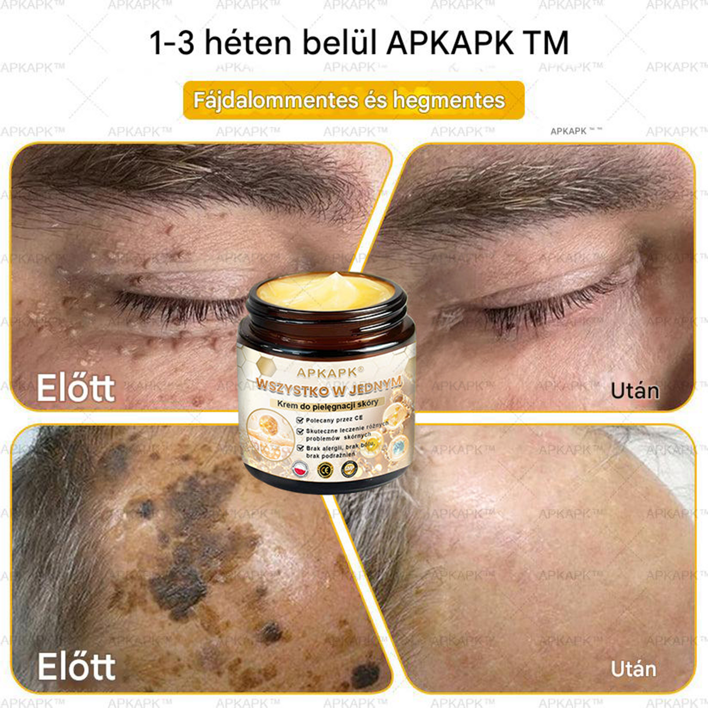 𝑨𝑷𝑲𝑨𝑷𝑲™ Hatékony krém a teljes bőrápoláshoz🔥