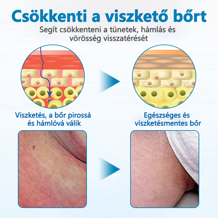 ✅Timilk® Férfi GentX Relief Krém