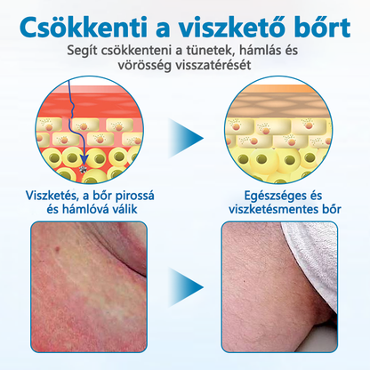 ✅Timilk® Férfi GentX Relief Krém